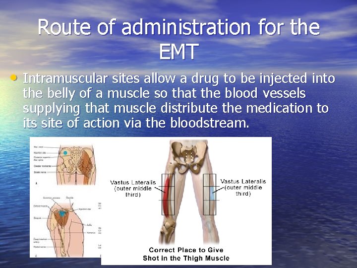 Route of administration for the EMT • Intramuscular sites allow a drug to be