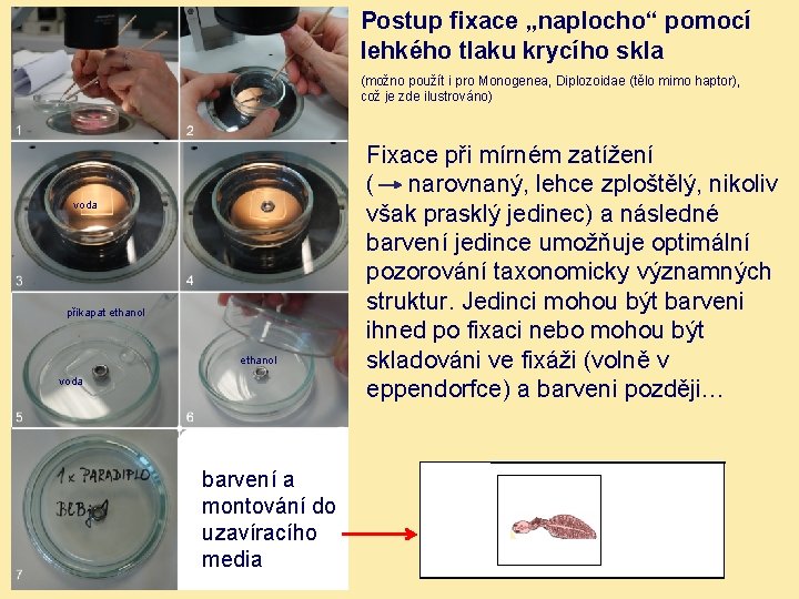 Postup fixace „naplocho“ pomocí lehkého tlaku krycího skla (možno použít i pro Monogenea, Diplozoidae