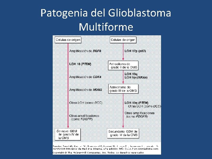 Patogenia del Glioblastoma Multiforme 