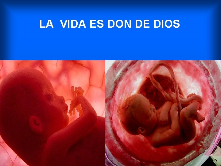 LA VIDA ES DON DE DIOS 