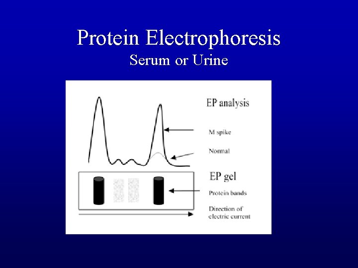 Protein Electrophoresis Serum or Urine 