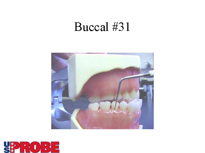 Buccal #31 