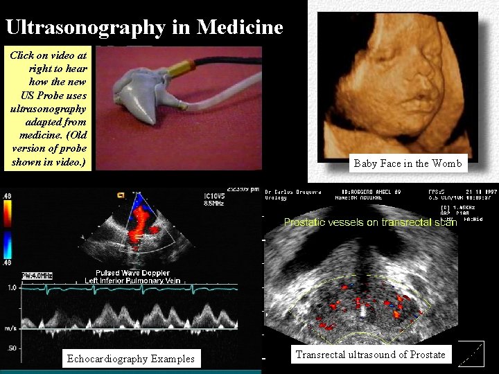 Ultrasonography in Medicine Click on video at right to hear how the new US