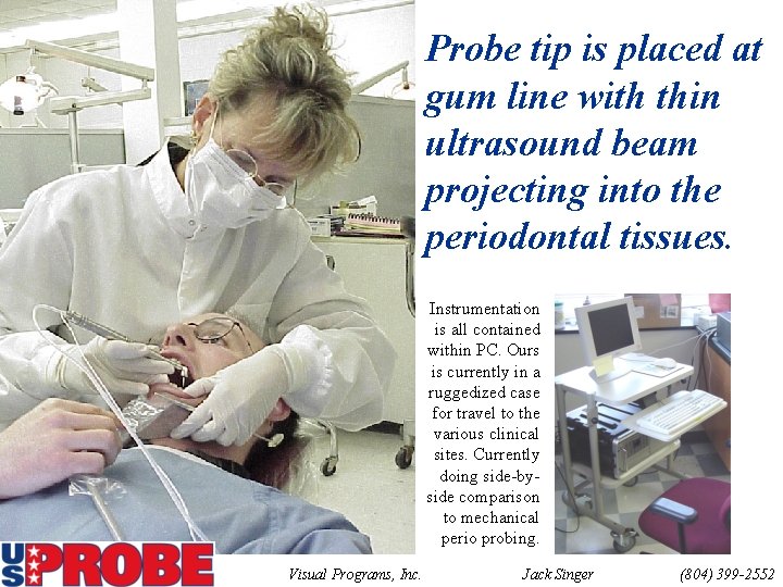 Probe tip is placed at gum line with thin ultrasound beam projecting into the