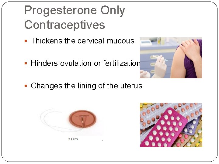 Progesterone Only Contraceptives § Thickens the cervical mucous § Hinders ovulation or fertilization §