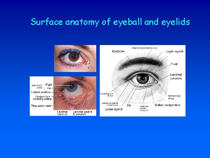 Surface anatomy of eyeball and eyelids 