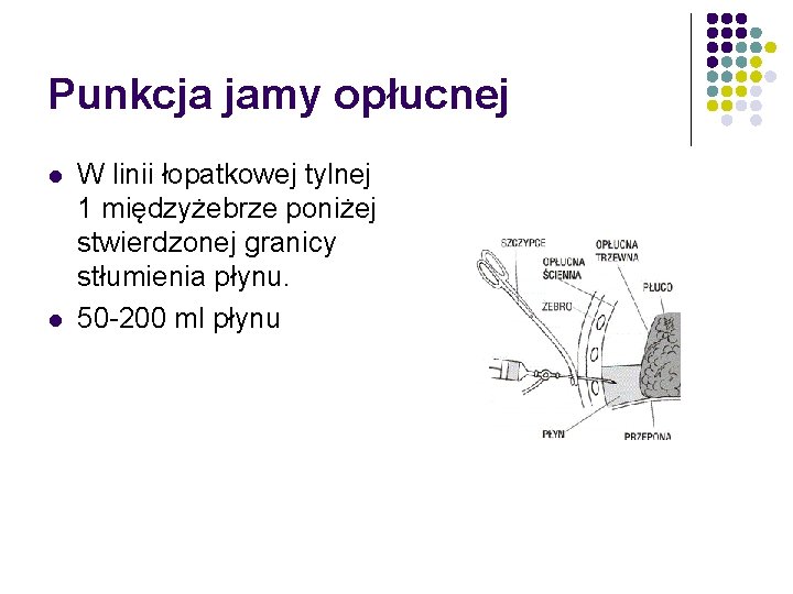 Punkcja jamy opłucnej l l W linii łopatkowej tylnej 1 międzyżebrze poniżej stwierdzonej granicy