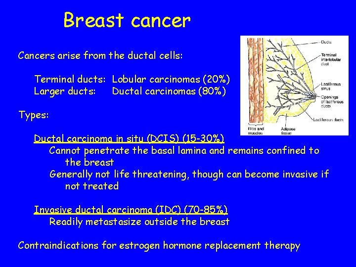 Breast cancer Cancers arise from the ductal cells: Terminal ducts: Lobular carcinomas (20%) Larger