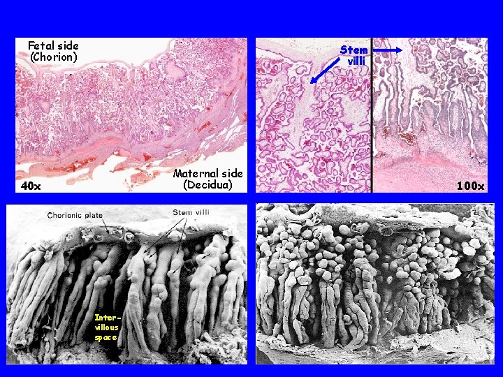 Fetal side (Chorion) Stem villi Maternal side (Decidua) 40 x Intervillous space 100 x