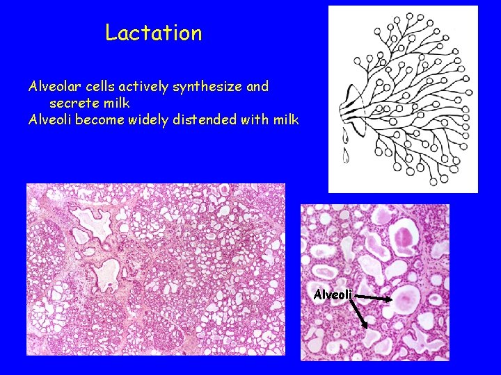 Lactation Alveolar cells actively synthesize and secrete milk Alveoli become widely distended with milk