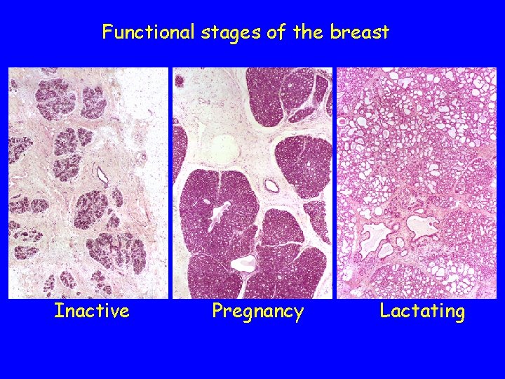 Functional stages of the breast Inactive Pregnancy Lactating 