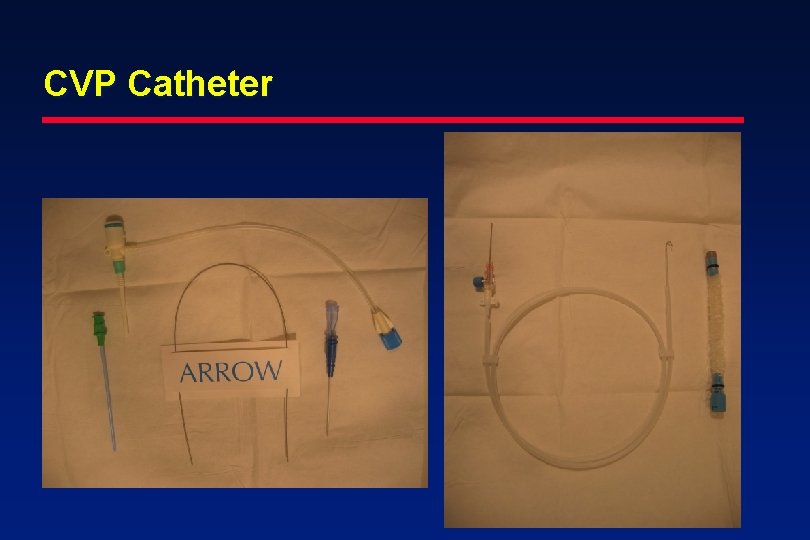 CVP Catheter 