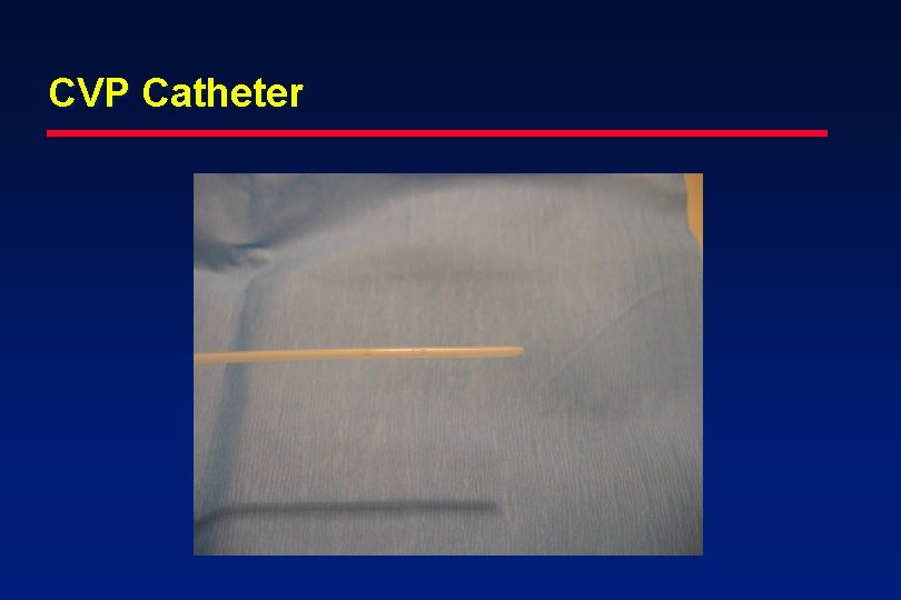 CVP Catheter 