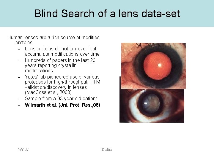 Blind Search of a lens data-set Human lenses are a rich source of modified