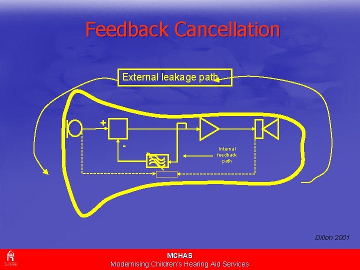 Feedback Cancellation External leakage path + - Internal feedback path Dillon 2001 MCHAS Modernising