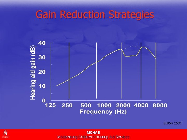 Gain Reduction Strategies Dillon 2001 MCHAS Modernising Children’s Hearing Aid Services 