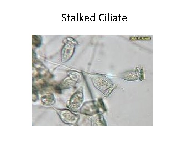 Stalked Ciliate 
