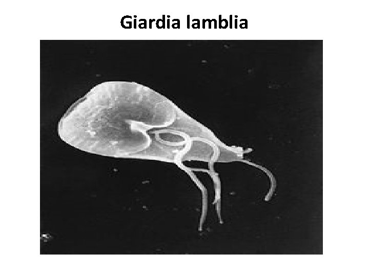 Giardia lamblia 