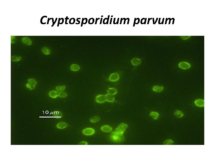 Cryptosporidium parvum 