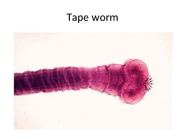 Tape worm 