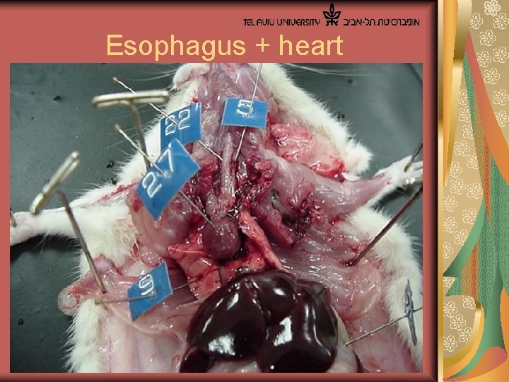  Esophagus + heart 