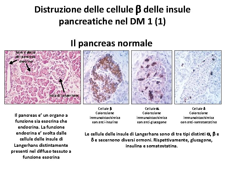 Distruzione delle cellule b delle insule pancreatiche nel DM 1 (1) Il pancreas normale