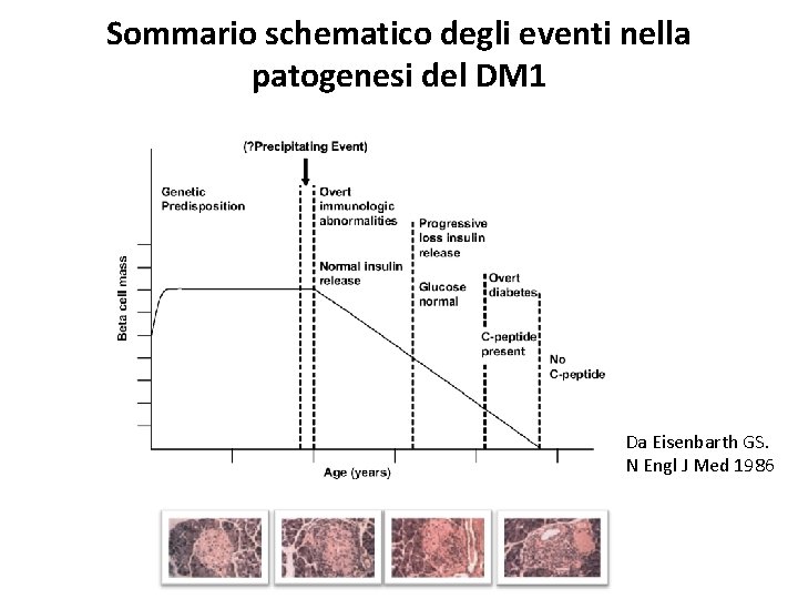 Sommario schematico degli eventi nella patogenesi del DM 1 Da Eisenbarth GS. N Engl