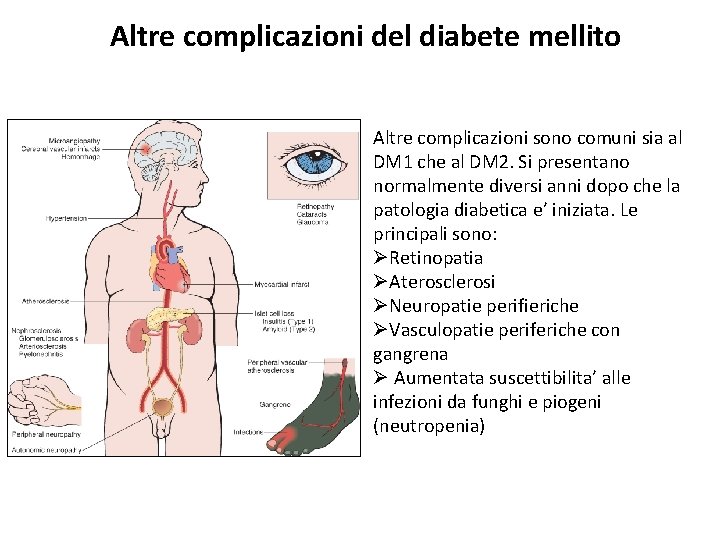 Altre complicazioni del diabete mellito Altre complicazioni sono comuni sia al DM 1 che