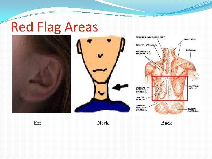 Red Flag Areas Ear Neck Back 