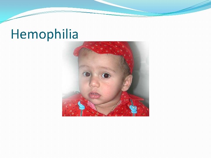 Hemophilia 