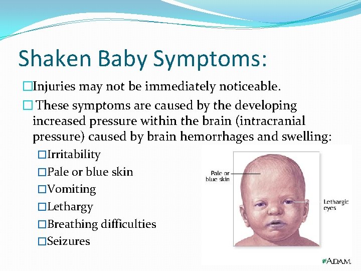 Shaken Baby Symptoms: �Injuries may not be immediately noticeable. � These symptoms are caused