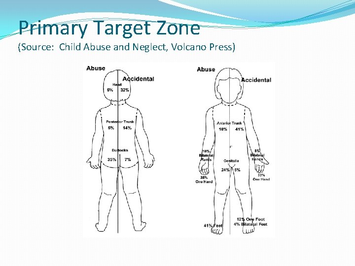 Primary Target Zone (Source: Child Abuse and Neglect, Volcano Press) 
