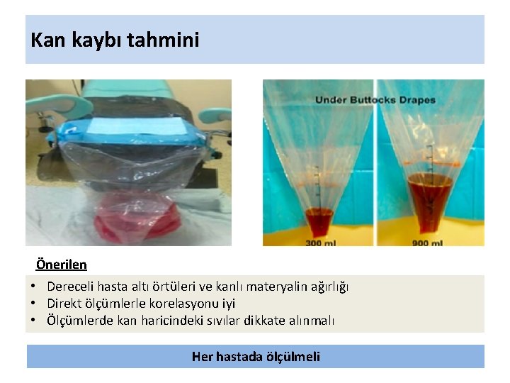Kan kaybı tahmini Önerilen • Dereceli hasta altı örtüleri ve kanlı materyalin ağırlığı •