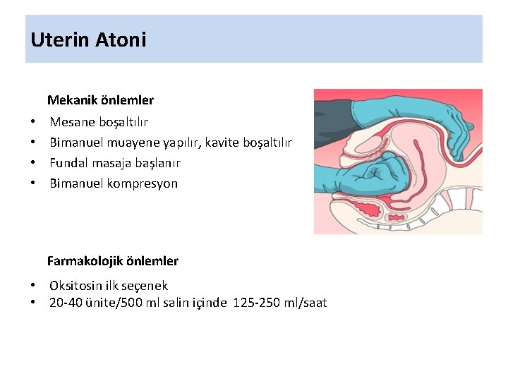 Uterin Atoni Mekanik önlemler • • Mesane boşaltılır Bimanuel muayene yapılır, kavite boşaltılır Fundal