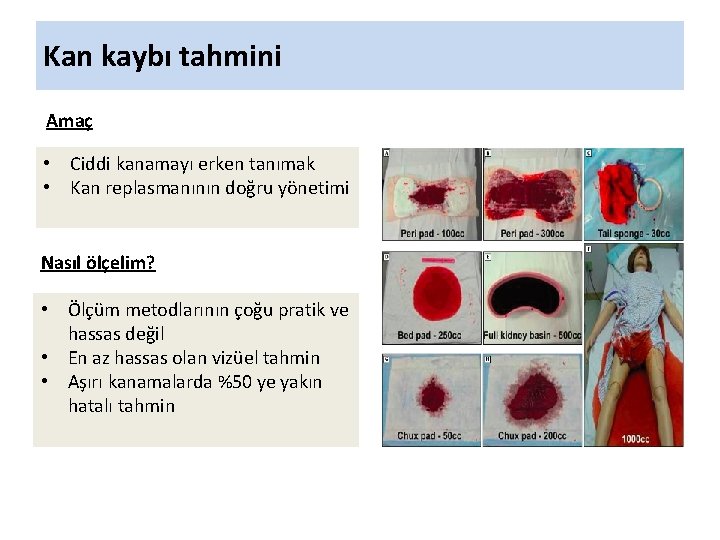 Kan kaybı tahmini Amaç • Ciddi kanamayı erken tanımak • Kan replasmanının doğru yönetimi