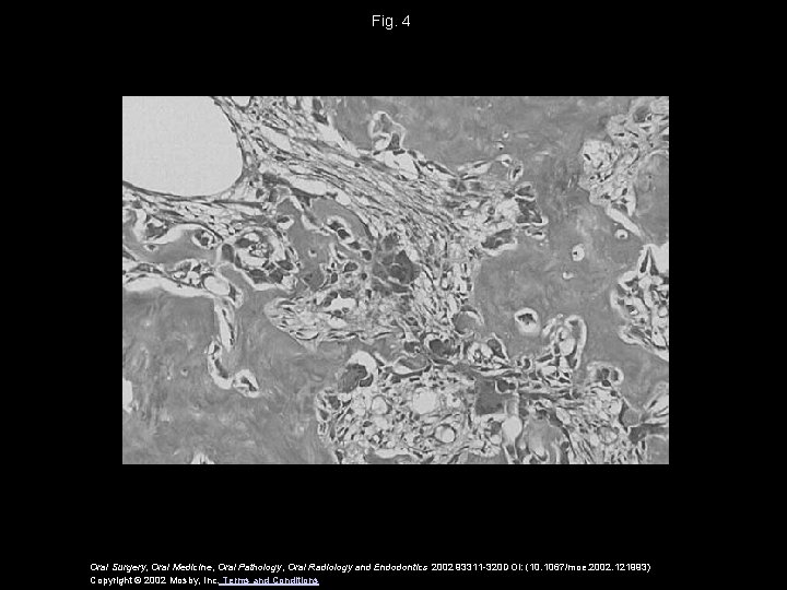 Fig. 4 Oral Surgery, Oral Medicine, Oral Pathology, Oral Radiology and Endodontics 2002 93311 Fig. 4 Oral Surgery, Oral Medicine, Oral Pathology, Oral Radiology and Endodontics 2002 93311