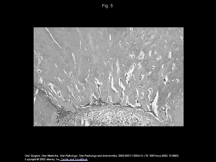 Fig. 5 Oral Surgery, Oral Medicine, Oral Pathology, Oral Radiology and Endodontics 2002 93311 Fig. 5 Oral Surgery, Oral Medicine, Oral Pathology, Oral Radiology and Endodontics 2002 93311