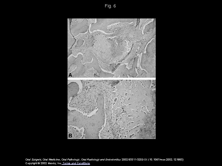 Fig. 6 Oral Surgery, Oral Medicine, Oral Pathology, Oral Radiology and Endodontics 2002 93311 Fig. 6 Oral Surgery, Oral Medicine, Oral Pathology, Oral Radiology and Endodontics 2002 93311