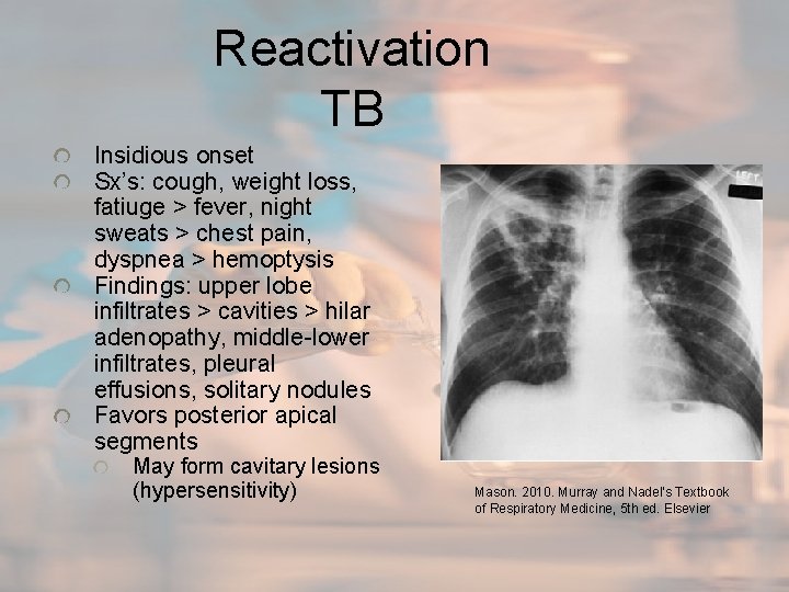 Reactivation TB Insidious onset Sx’s: cough, weight loss, fatiuge > fever, night sweats >