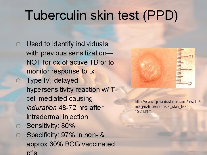 Tuberculin skin test (PPD) Used to identify individuals with previous sensitization— NOT for dx