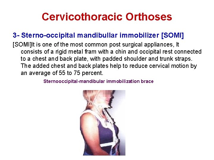 Cervicothoracic Orthoses 3 - Sterno-occipital mandibullar immobilizer [SOMI]It is one of the most common