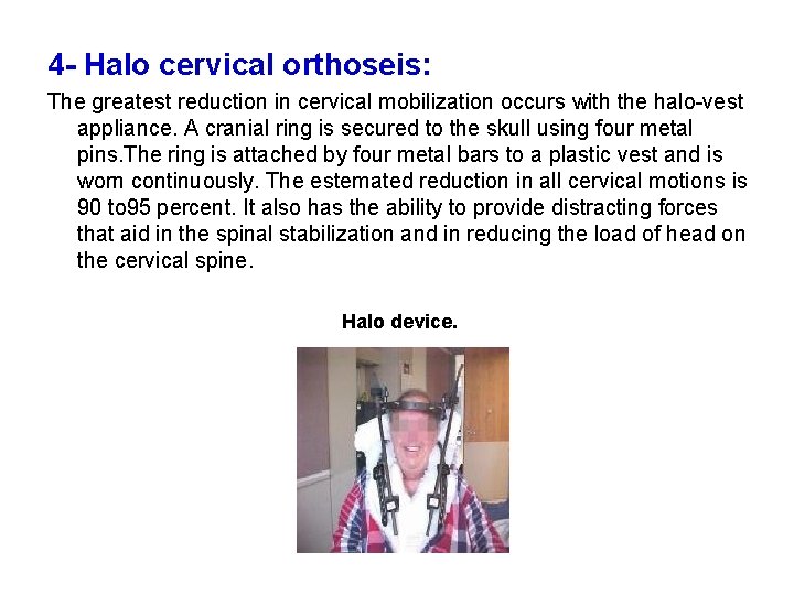 4 - Halo cervical orthoseis: The greatest reduction in cervical mobilization occurs with the