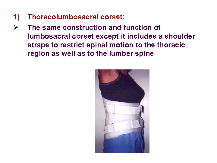 1) Ø Thoracolumbosacral corset: The same construction and function of lumbosacral corset except it