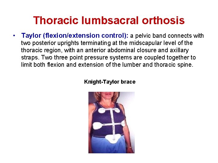 Thoracic lumbsacral orthosis • Taylor (flexion/extension control): a pelvic band connects with two posterior