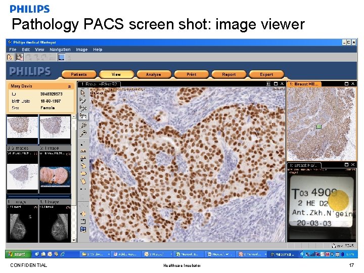 Pathology PACS screen shot: image viewer CONFIDENTIAL Healthcare Incubator 17 