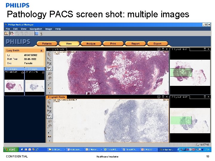 Pathology PACS screen shot: multiple images CONFIDENTIAL Healthcare Incubator 18 