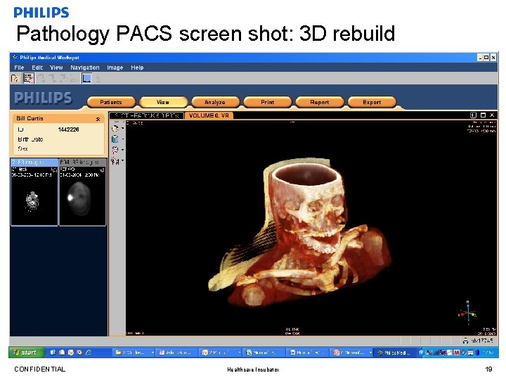 Pathology PACS screen shot: 3 D rebuild CONFIDENTIAL Healthcare Incubator 19 