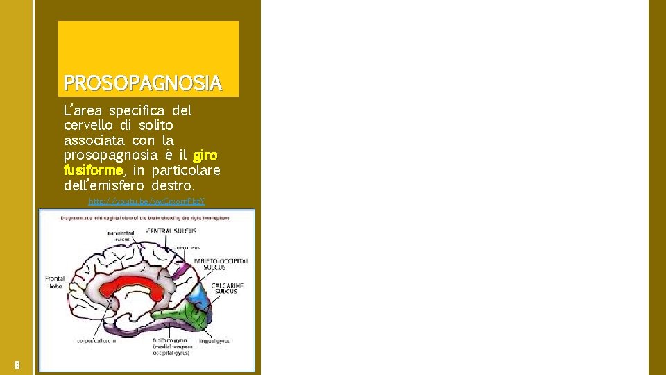 PROSOPAGNOSIA L’area specifica del cervello di solito associata con la prosopagnosia è il giro