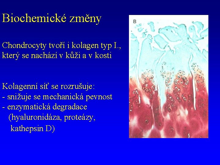 Biochemické změny Chondrocyty tvoří i kolagen typ I. , který se nachází v kůži