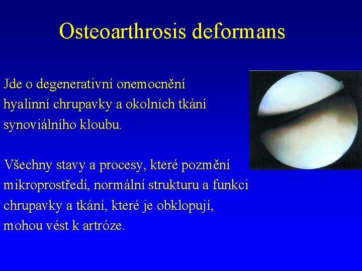Osteoarthrosis deformans Jde o degenerativní onemocnění hyalinní chrupavky a okolních tkání synoviálního kloubu. Všechny